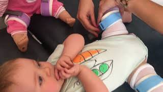 Orthokids DBB Hip Abduction Brace - How to put on the brace
