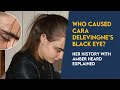 Who caused Cara Delevingne's black eye? Her history with Amber Heard and Johnny Depp exposed.