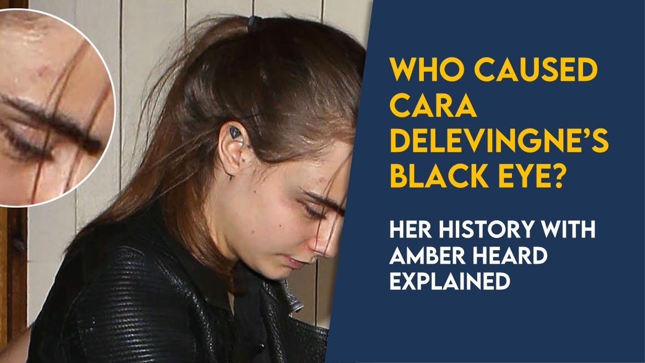 Who caused Cara Delevingne's black eye? Her history with Amber Heard