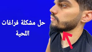 حل مشكلة فراغات اللحية  - شاهد هزا  الحل السريع صبغة# بايجن