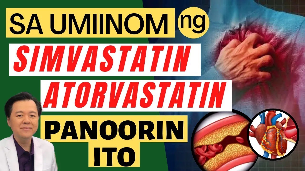 Sa Umiinom ng  SIMVASTATIN, ATORVASTATIN, Panoorin Ito - By Doc Willie Ong