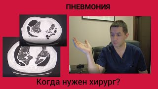 картинка: пневмония. Когда нужен хирург?