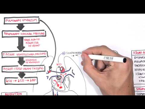 Pulmonary Embolism PART I (Overview)