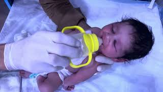 Birth Asphyxia Baby Part 2 Condition Improved After Continuous Fits Starting Oral Feeding NICU Upda