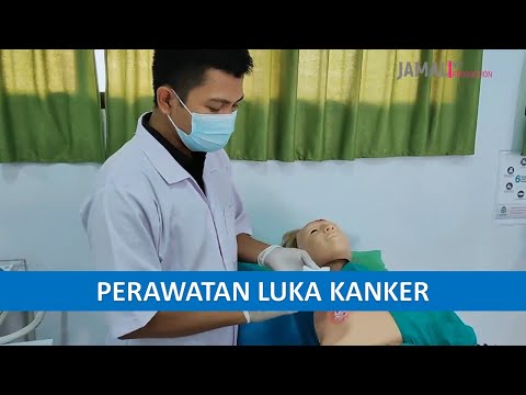 Perawatan Luka Kanker