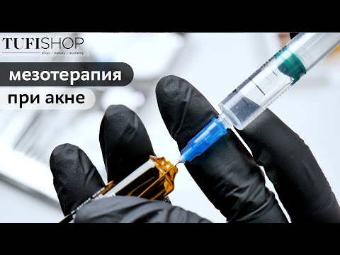 Видео: Най-добрите органични продукти за склонна към акне кожа