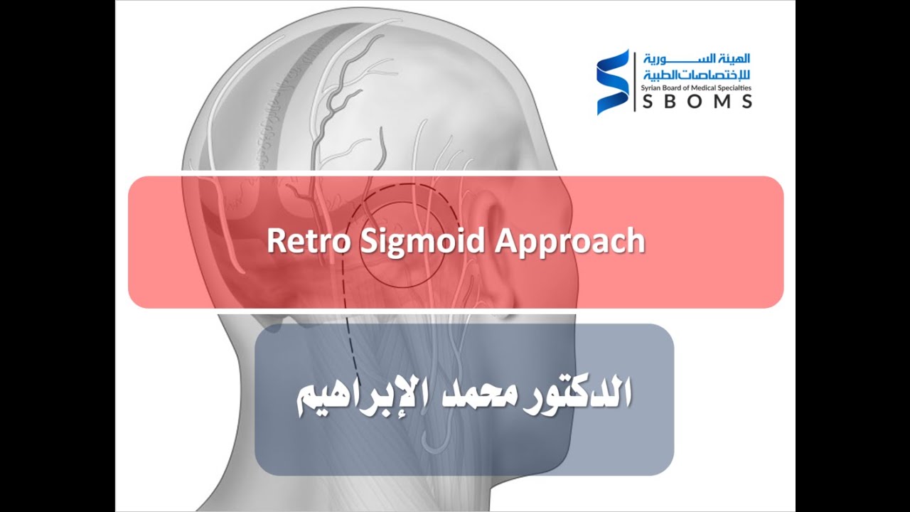 Retro Sigmoid Approach - YouTube