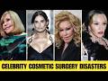 10 Celebrity Plastic Surgery Disasters – You’d Never Recognize Them Today! | Then and Now 2026