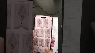 Card 4 Item 5 Virginity & Defloration Forensic Medicine