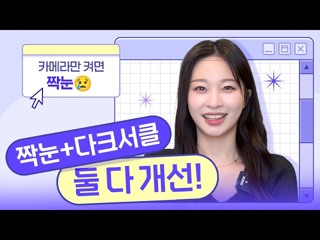 카메라에 더 잘 보이는 짝눈과 다크서클|듀얼트임+눈밑지방재배치 전 인터뷰