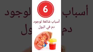 6 أسباب شائعة لوجود دمٍ في البول 