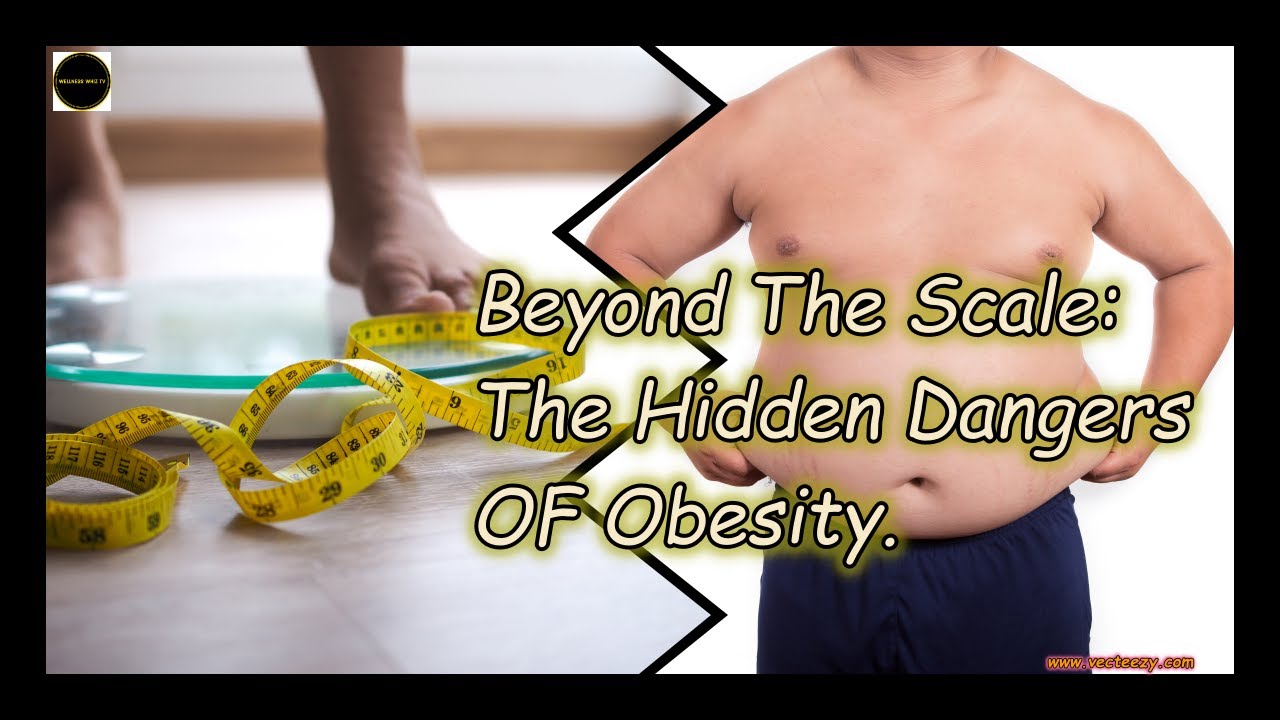 "Beyond the Scale: Exploring the Hidden Dangers of Obesity" - YouTube