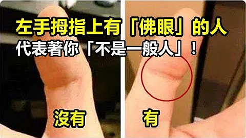 左手拇指上有「佛眼」的人 , 代表著你「不是一般人」！ - 天天要聞