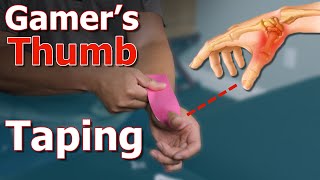 One SIMPLE Taping Method To Relieve Gamer's Thumb | Taught By A Physical Therapist