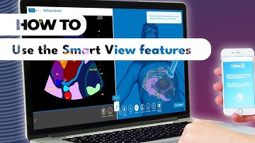 #howto read ultrasound images with SmartView in diSplay U/S simulator
