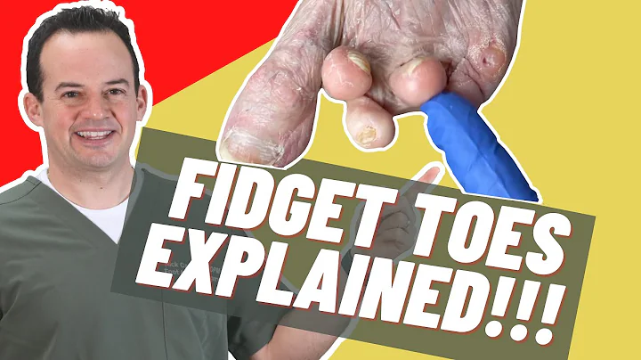 Fidget Toes Explained! | Dr. Nick Campitelli