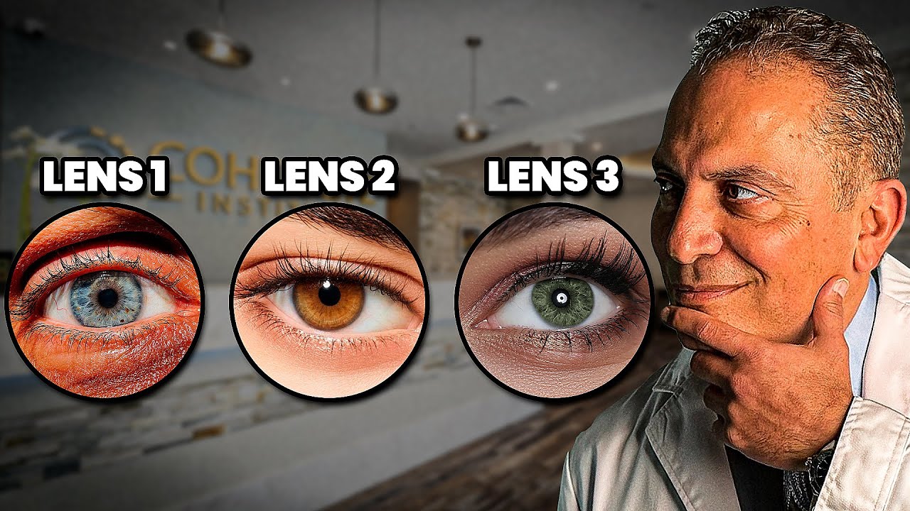Which Cataract Lens is Best for You? (REVIEW)