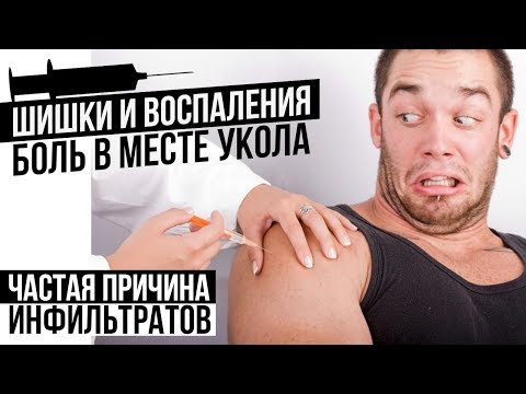 ШИШКИ ПОСЛЕ УКОЛОВ / Болит место инъекции (Инфильтраты и воспаления)