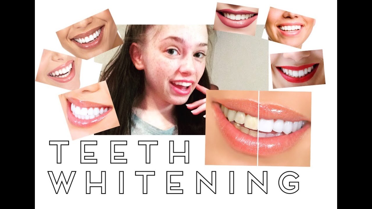 Real working Dollar store one review smile whitening teeth before and after YouTube