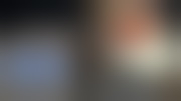 How to get a reliable initial stability 2nd case_Mx. fully edentulous case!