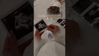 اللهم هون علي ما تبقى من حملي ويسر ولادتي🤰🏻🤱🏻👶🏻❤️