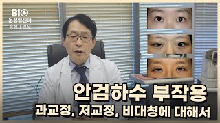 안검하수 부작용 과교정, 저교정, 눈높이를 맞추는데 문제가 생기는 경우 [비아이오성형외과 홍성표원장]