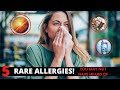 Top 5 Rare Allergies You May Not Have Heard Of - Most Strangest Allergies 2022