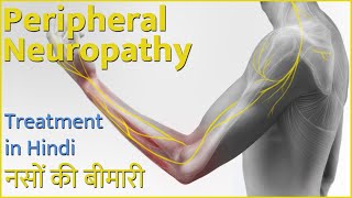 PERIPHERAL NEUROPATHIC PAIN  IN HINDI- what is peripheral neuropathy? what can be done about it? screenshot 3