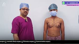 Gynecomastia Marking, Planning & Surgery | Dr. Jayanta Bain plastic surgeon | New Town, Kolkata 