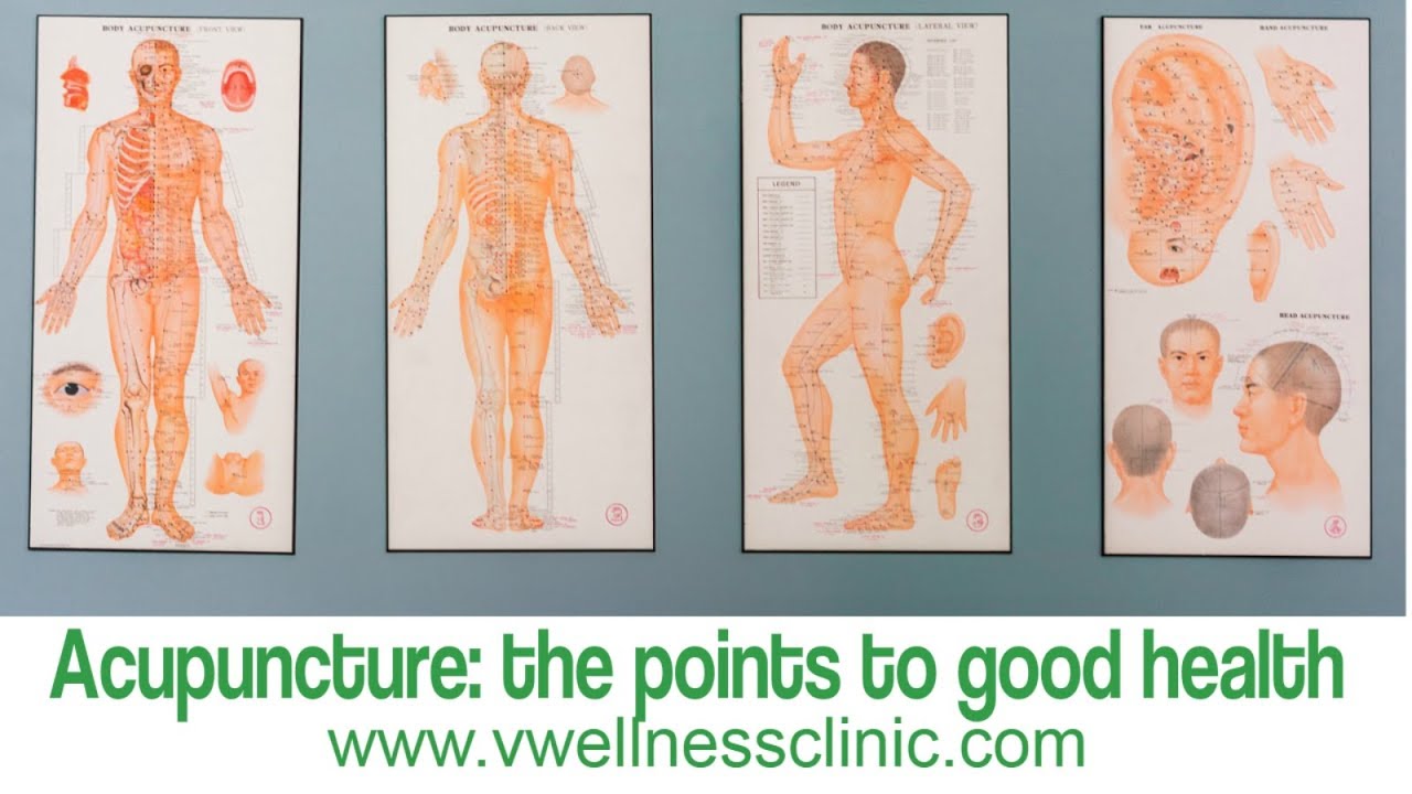 Acupuncture treatments Vitality Wellness Clinic YouTube