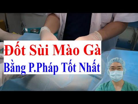 Phương Pháp Chữa Bệnh Sùi Mào Gà Tốt Nhất Hiện Nay Tại Bác Sĩ Sắc Nam Học