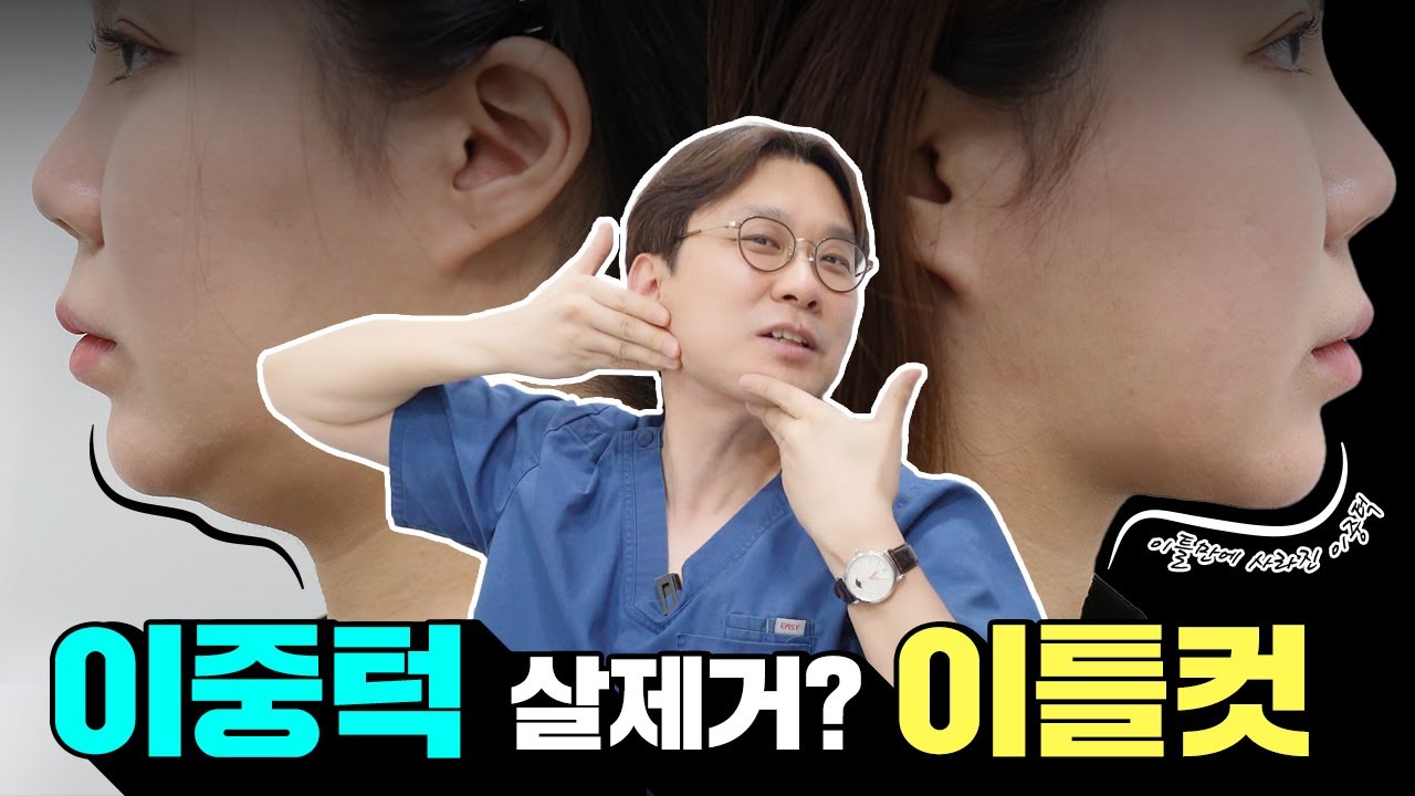 이중턱? 이틀 만에 사라졌습니다!