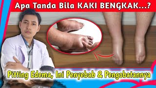 Download Lagu Pitting Edema, Ketahui Penyebab dan Cara Mengatasinya || dr. Andi MP3