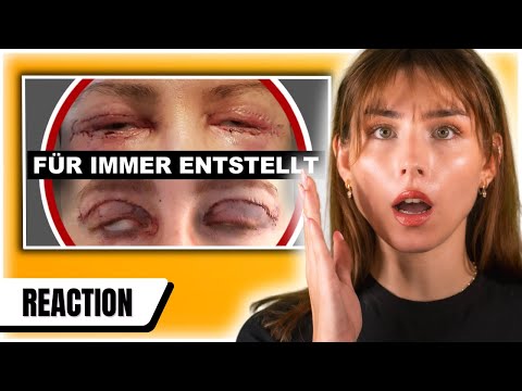 GEFÄHRLICHE Beautyeingriffe + EIGENE Erfahrungen 😭 | REACTION auf ALICIAJOE