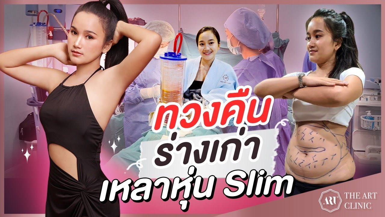 ดูดไขมัน : ก่อนดูดน้ำหนัก 62 kg ลดเหลือ 53 kg ที่The Art Clinic