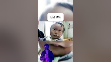 Cậu bé này có đến 2 khuôn mặt 🤯  #matnahuyenbi #Chuyenma #kinhdi #shorts