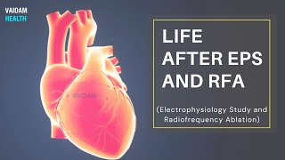 Life after EPS and RFA (Electrophysiology Study and Radiofrequency Ablation)