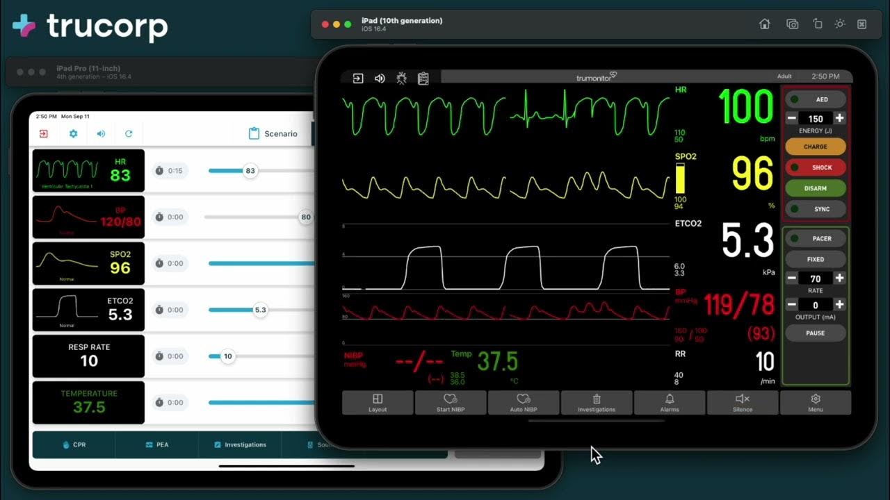 TruMonitor Quick Start Basic Controls YouTube