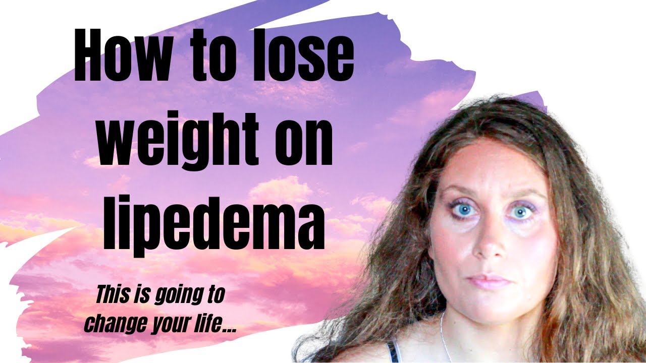 How to lose weight on lipedema YouTube