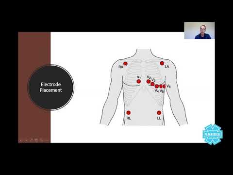 Video: Manakah dari berikut ini yang merupakan sistem pemerolehan EKG nirkabel?