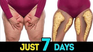 Lose Inner Thigh Fat Fast 🔥 | 7 Days Challenge (No Equipment Workout)