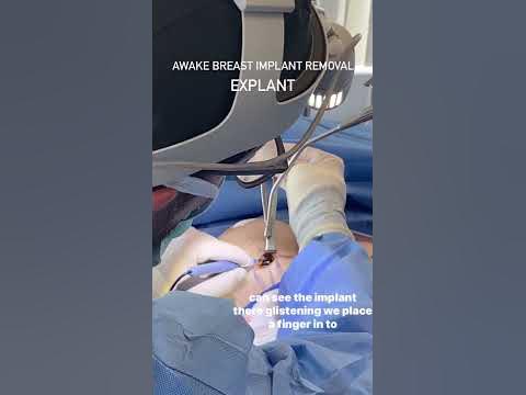 Awake Breast Reduction Beverly Hills - Ideal Face & Body