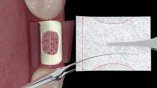 How To Use - RTR+ & RTR+ Membrane