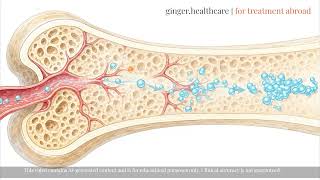 Metastatic Bone Disease: How Doctors Treat It Today