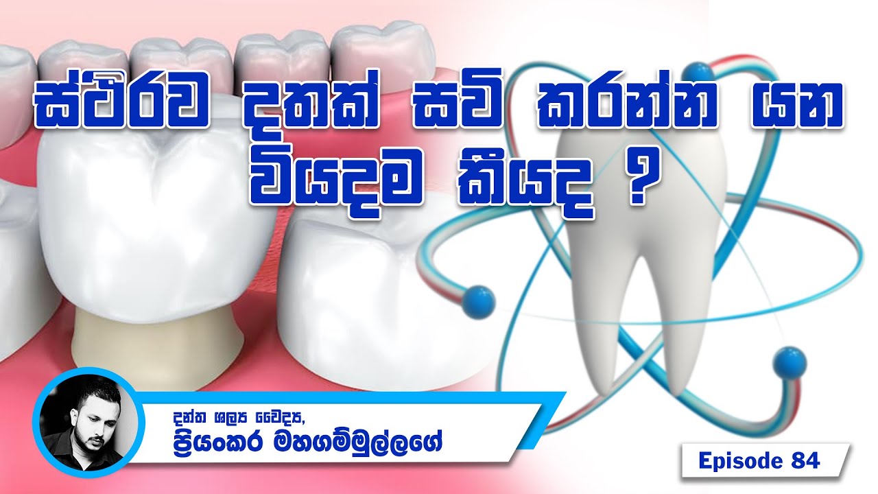 ස්ථිරව දතක් සවි කරන්න යන වියදම කීයද ? - Episode 84