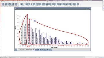 Describing a distribution using a dotplot