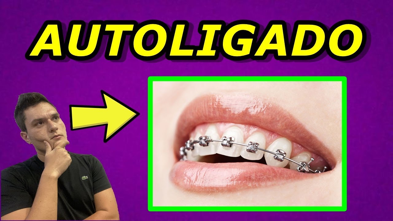 APARELHO AUTOLIGADO É MAIS RÁPIDO MESMO? | VERDADE DEFINITIVA REVELADA!!!