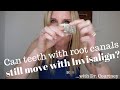 CAN TEETH WITH ROOT CANALS HAVE INVISALIGN 2024| Why can teeth with root canals still move?