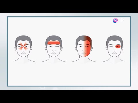 Почему возникает мигрень?