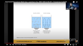 Ultrasonic Scaling | Case-based Discussions Made Easy | Learning Is Fun | NEET MDS & INI-CET screenshot 3